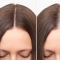 The Truth About Hair Loss: What is the Average Age for Hair Loss to Occur?