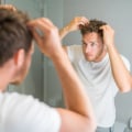 Exploring Effective Over-the-Counter Treatments for Hair Loss