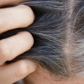 The Truth About Hair Loss and Natural Supplements