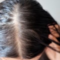 The Link Between Hormonal Changes and Hair Loss