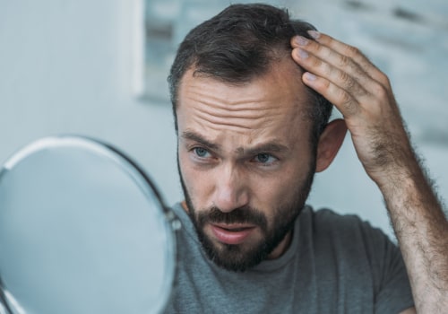 The Truth About Hair Loss: Can Excessive Styling or Heat Damage Lead to Hair Loss?