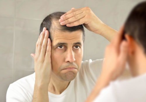 The Impact of Hair Loss on Self-Esteem