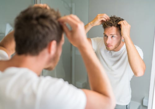 Exploring Effective Over-the-Counter Treatments for Hair Loss