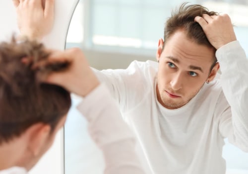 The Best Treatment for Hair Loss: Expert Insights