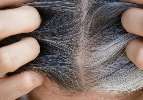 The Truth About Hair Loss and Natural Supplements
