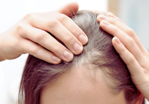 Hair Loss: Understanding the Connection with Medical Treatments