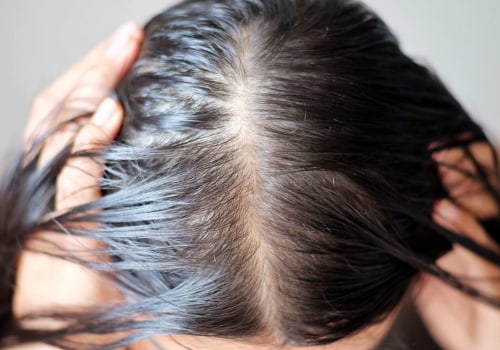 The Link Between Hormonal Changes and Hair Loss