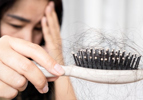 Debunking Common Myths About Hair Loss